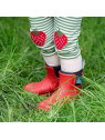 Little Green Radicals - Bio Kinder Jersey Hose mit Streifen und Erdbeer-Patches